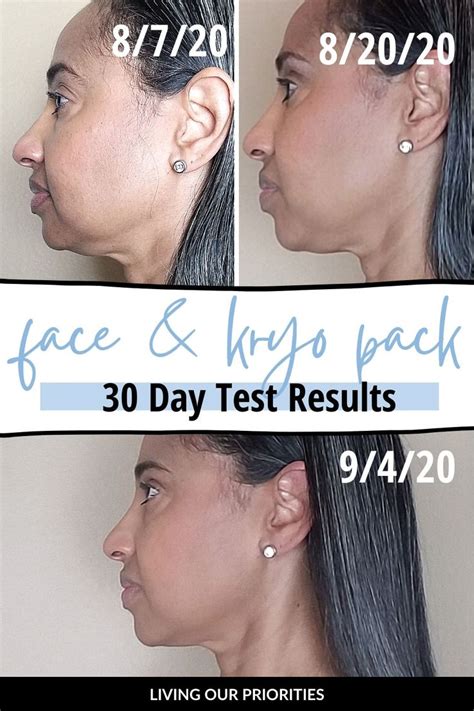 fascia blasting results